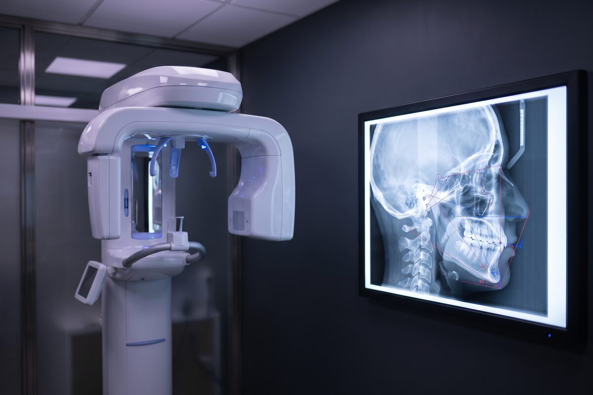 3D-CT 정밀 안전 진단 장비와 두부 계측 진단 영상 예시 이미지