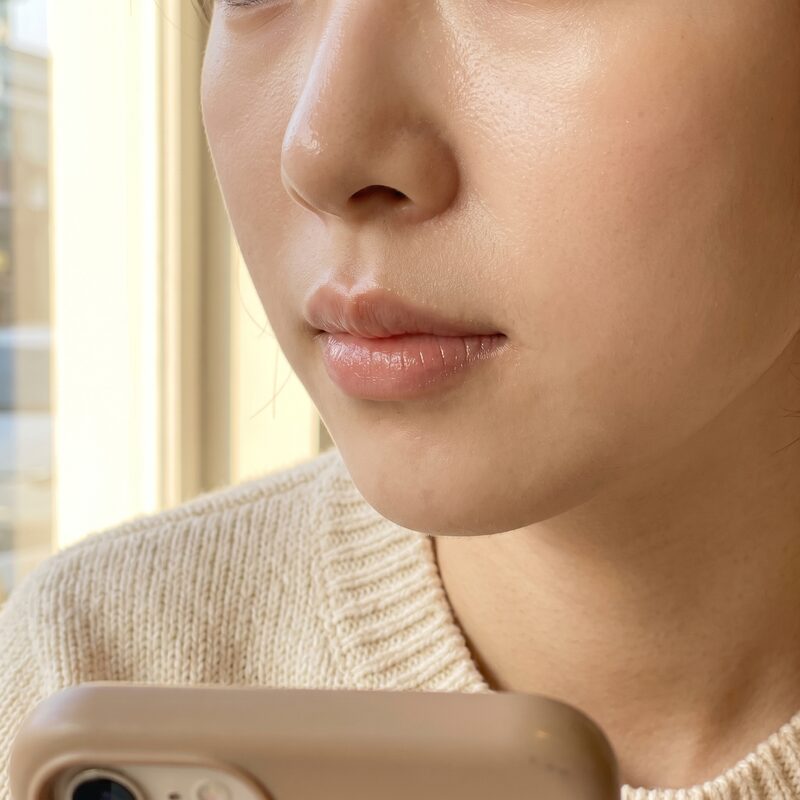 코성형 뷰티 컨셉 — AI 생성 예시 이미지