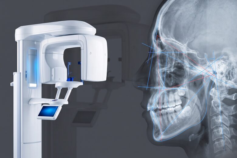 3D-CT 정밀 안전 진단 개념 이미지 — 화이트 CT 스캐너 장비와 두개 측면 계측 라인 합성 (AI 생성 예시 이미지)