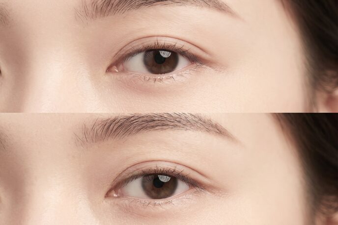눈매교정 후 눈가 라인을 보여주는 클로즈업 개념 이미지