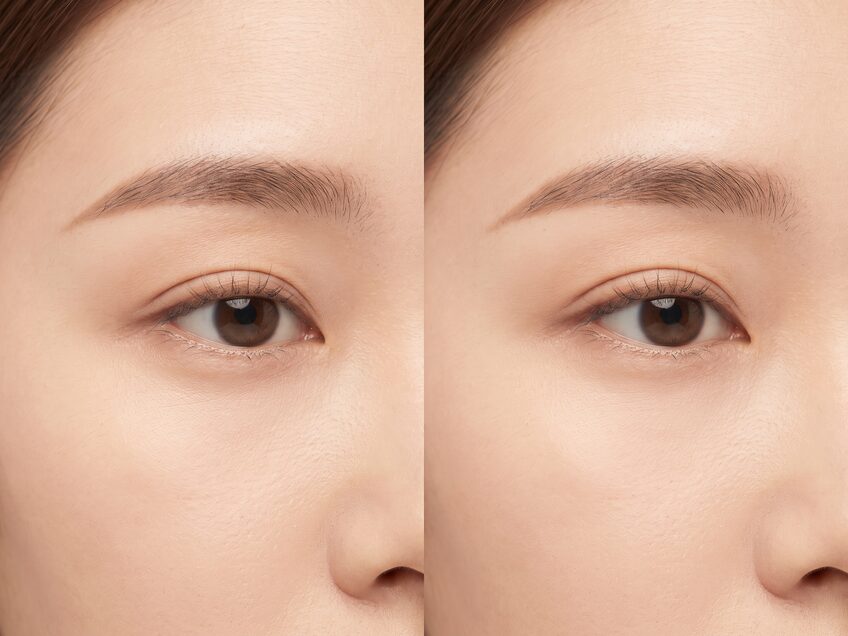 눈썹과 윗눈꺼풀만 담은 비식별 개념 클로즈업 — 인폴드 형태의 자연스러운 쌍꺼풀 라인