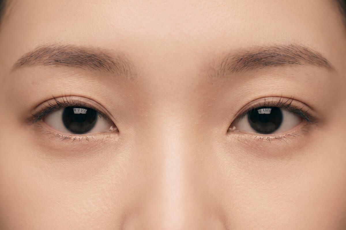 눈가만 담은 비식별 개념 이미지 — 절개 눈매교정 안내용