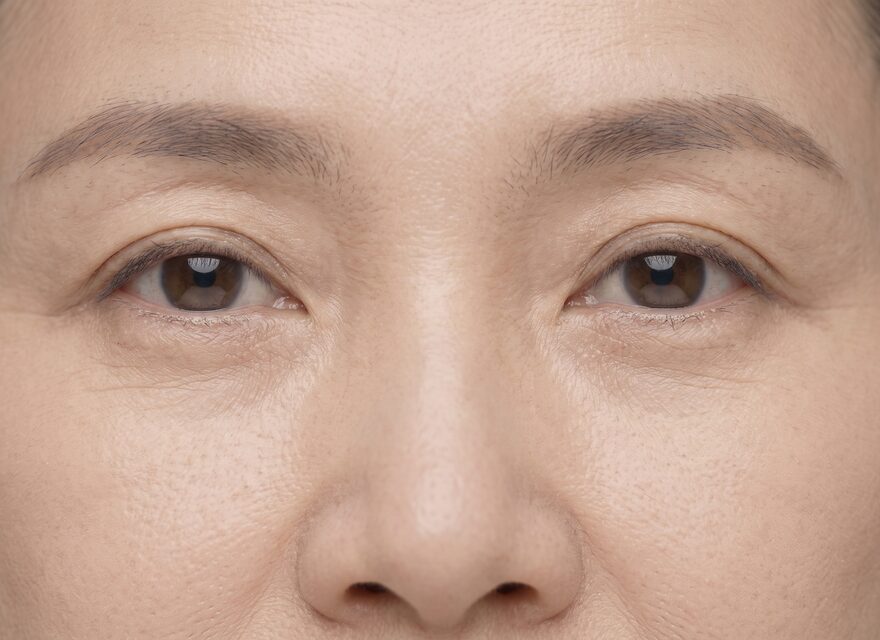 제자리트임 후기 – 눈가 비식별 개념 예시 이미지