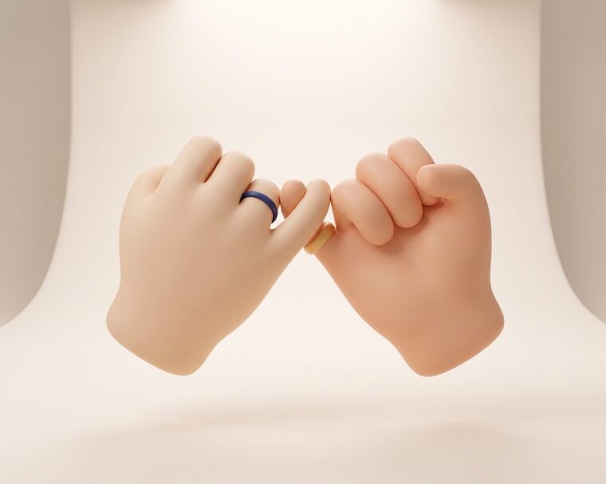 눈밑지방 재배치 이벤트 이미지 — 눈밑 라인이 보이는 근접 컷