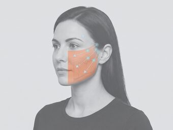 진피층 삽입 경로를 표시한 단계 도해