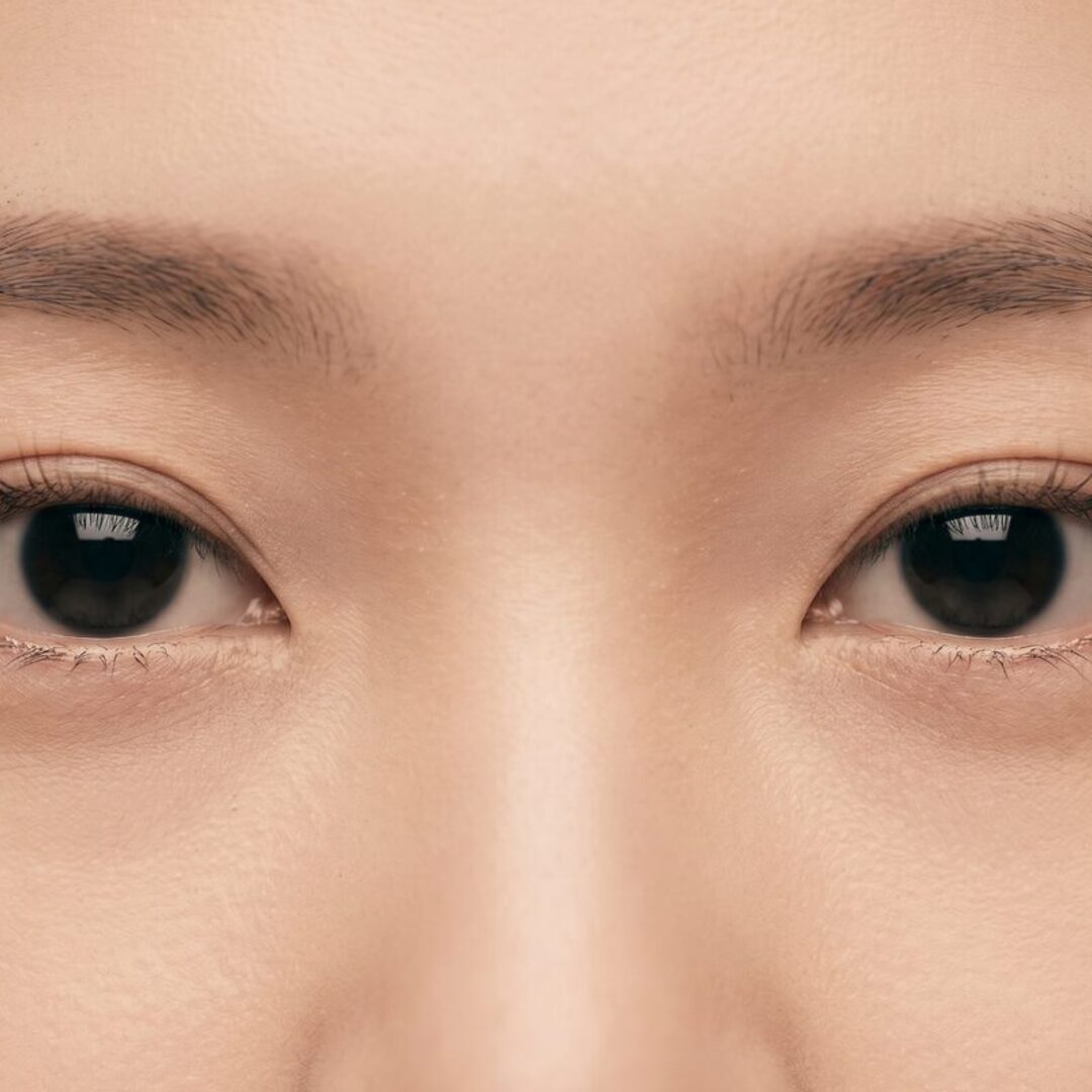 토탈 눈성형 이벤트 안내 이미지 (AI 생성 예시)