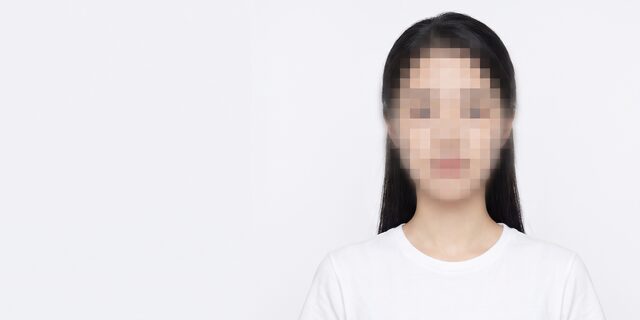 안면거상 개념 컷 썸네일. 얼굴 영역을 비식별 처리한 AI 생성 예시 이미지