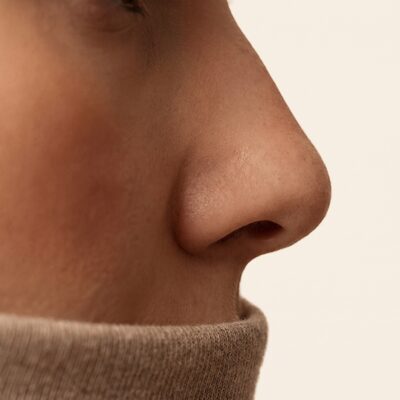 콧대가 낮은 옆선을 설명하는 비식별 개념 이미지