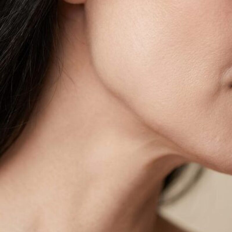 코끝 연골을 맞춤 커팅하고 지지대를 두 겹으로 겹쳐 세운 구조를 아래에서 본 코 단면 모식도