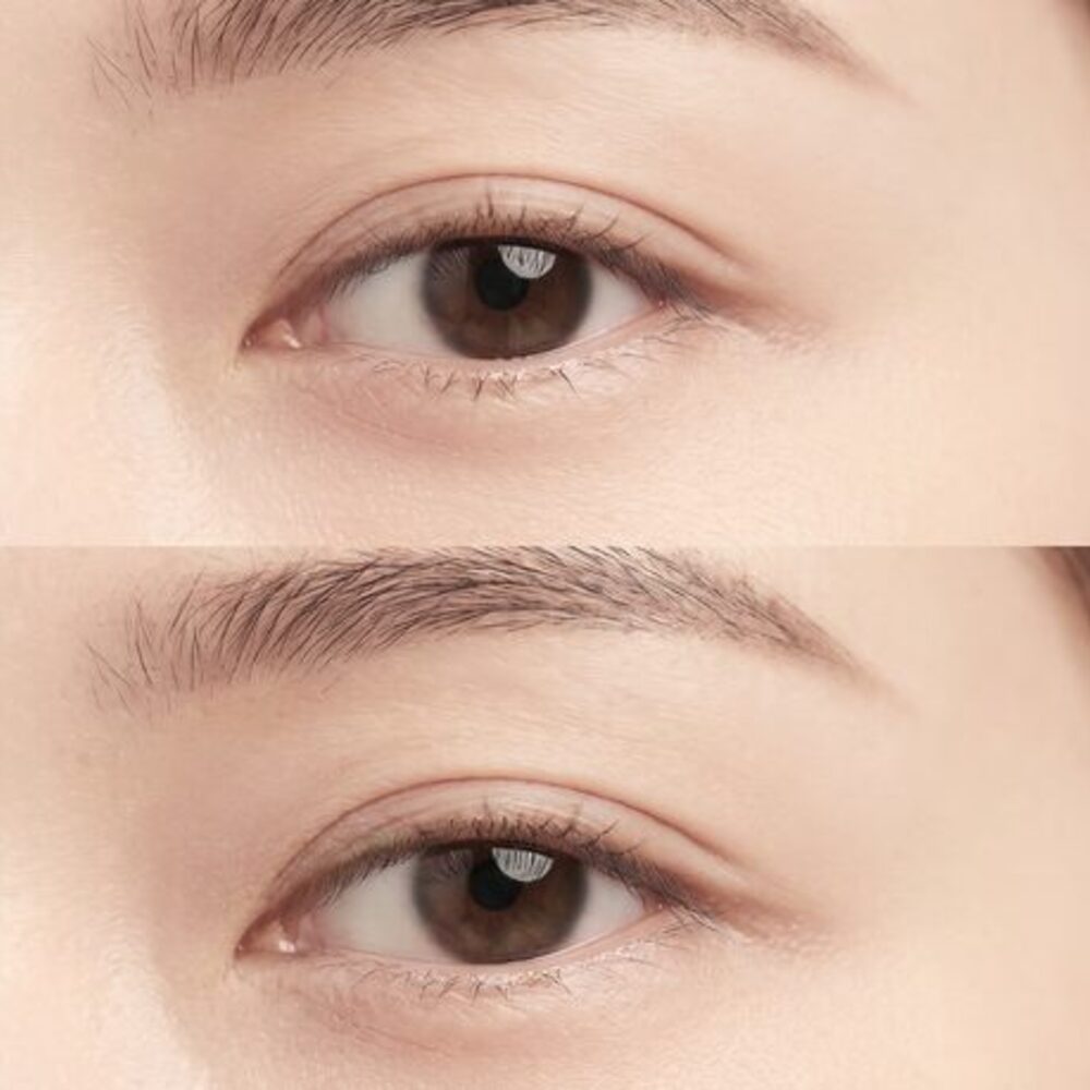 눈 아래에 그림자가 짙게 깔린 상태를 표현한 비식별 눈가 클로즈업 개념 이미지 (AI 생성 예시)