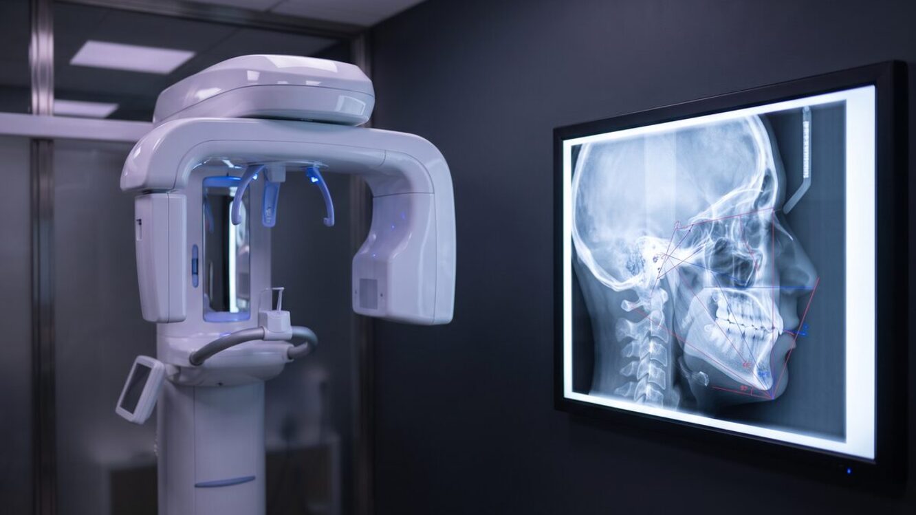 진단에 사용되는 3D CT 촬영 장비 전경