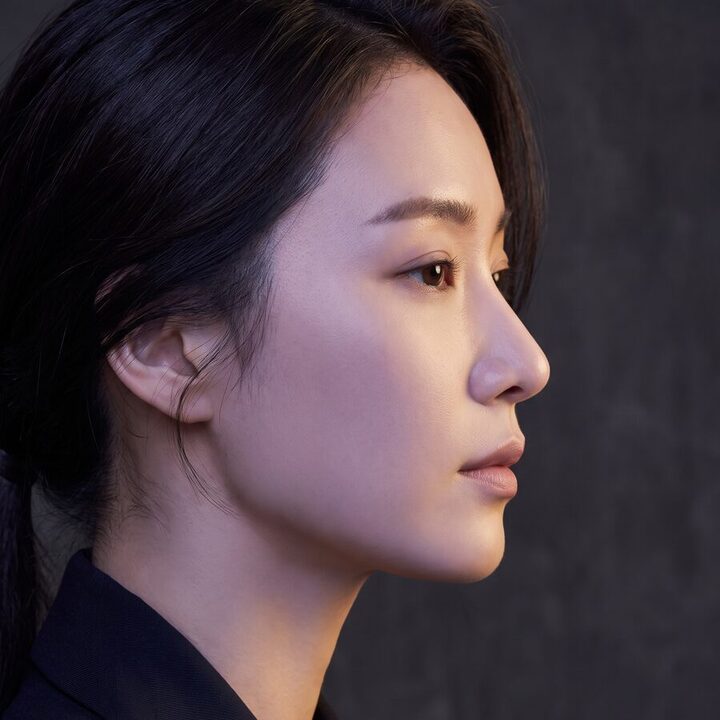 4단계 — 절개 부위를 봉합해 마무리한 상태의 측면 의학 일러스트