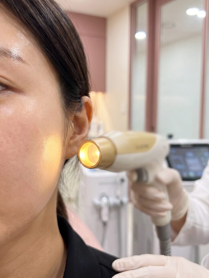 수술 전 낮은 콧대를 보여주는 옆모습 3D 일러스트